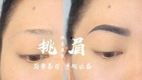 欧美点痣教程图解视频,图解视频精华概述