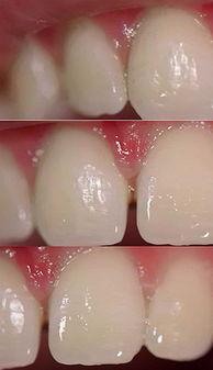 欧美牙齿特写视频教程,揭秘完美笑容的秘密